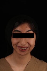 جراحی فک ارتوسرجری در کلینیک دکتر شهاب عزیزی