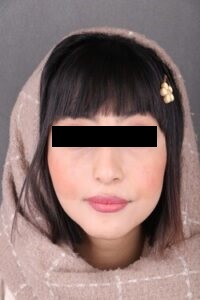 جراحی فک اصلاحی (ارتوسرجری) در کلینیک دکتر شهاب عزیزی