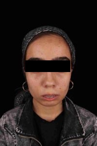 جراحی ارتوسرجری میترا سلطانی در کلینیک دکتر شهاب عزیزی