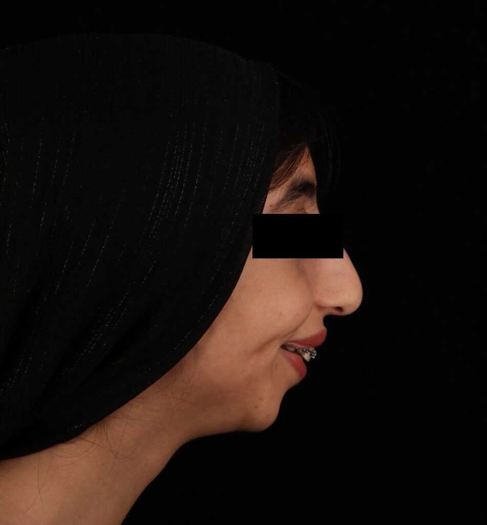 عمل جراحی فک در کلینیک دکتر شهاب الدین عزیزی