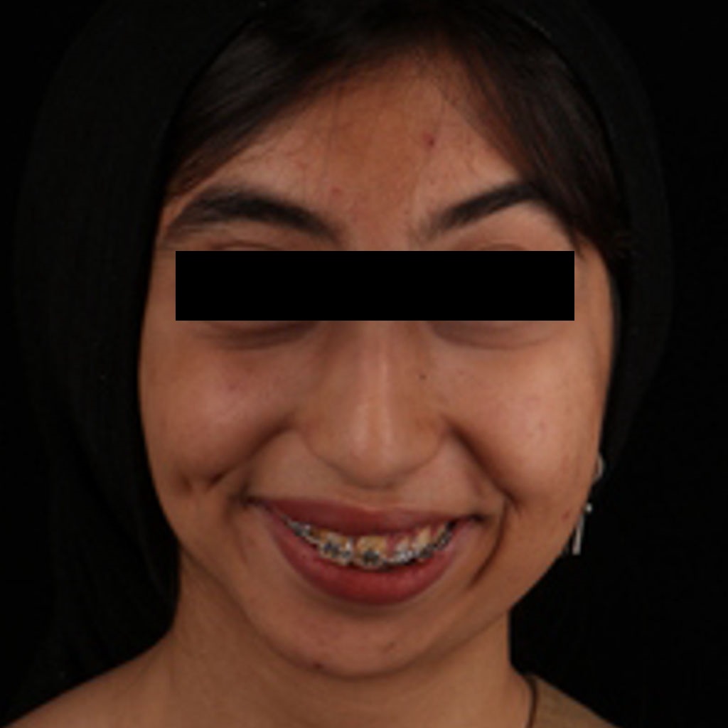 خدمات جراحی ناهنجاری مادرزادی فک در کلینیک دکتر شهاب الدین عزیزی