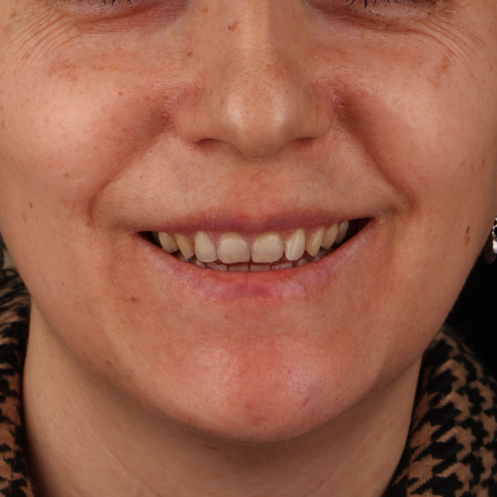 خدمات جراحی زیبایی فک در کلینیک دکتر شهاب الدین عزیزی