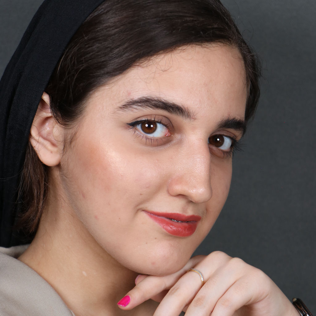 تصویر بعد از عمل جراحی فک خانم یزدان پناه توسط دکتر شهاب عزیزی