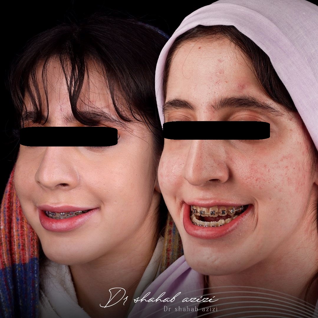 بهترین جراح متخصص زیبایی فک