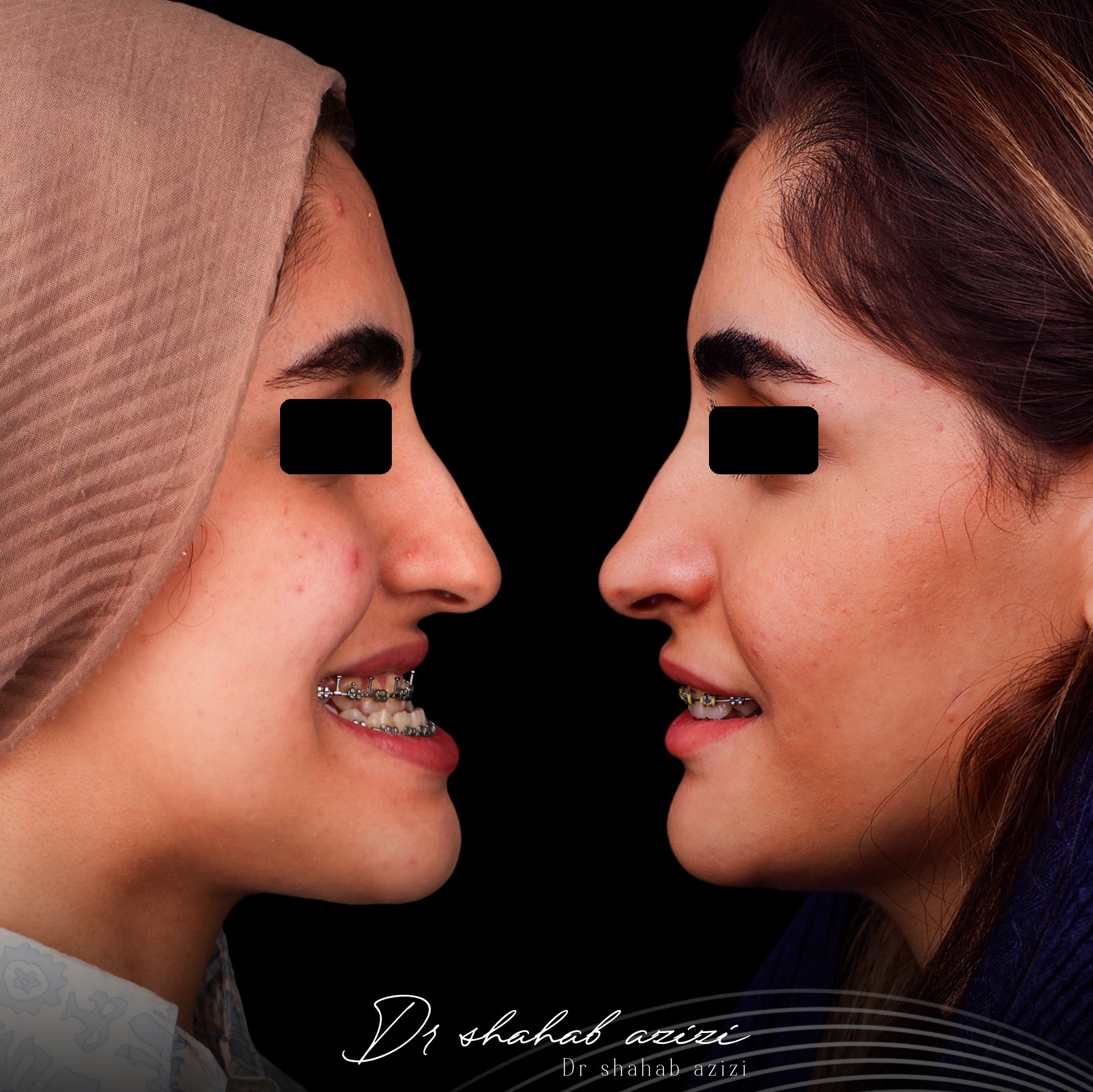 جراحی ناهنجاری مادرزادی فک در کلینیک دکتر شهاب الدین عزیزی