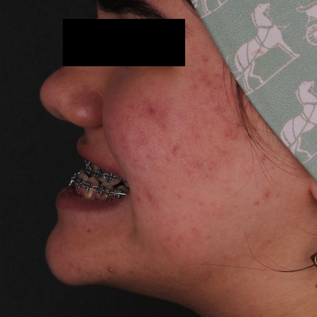 نمونه جراحی مشکلات مادرزادی فک