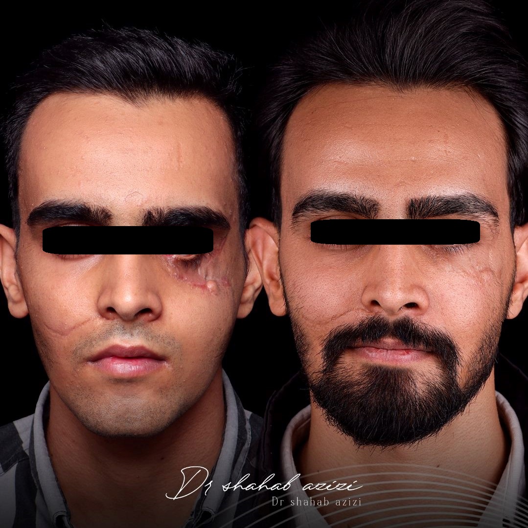 عمل تروما فک و صورت