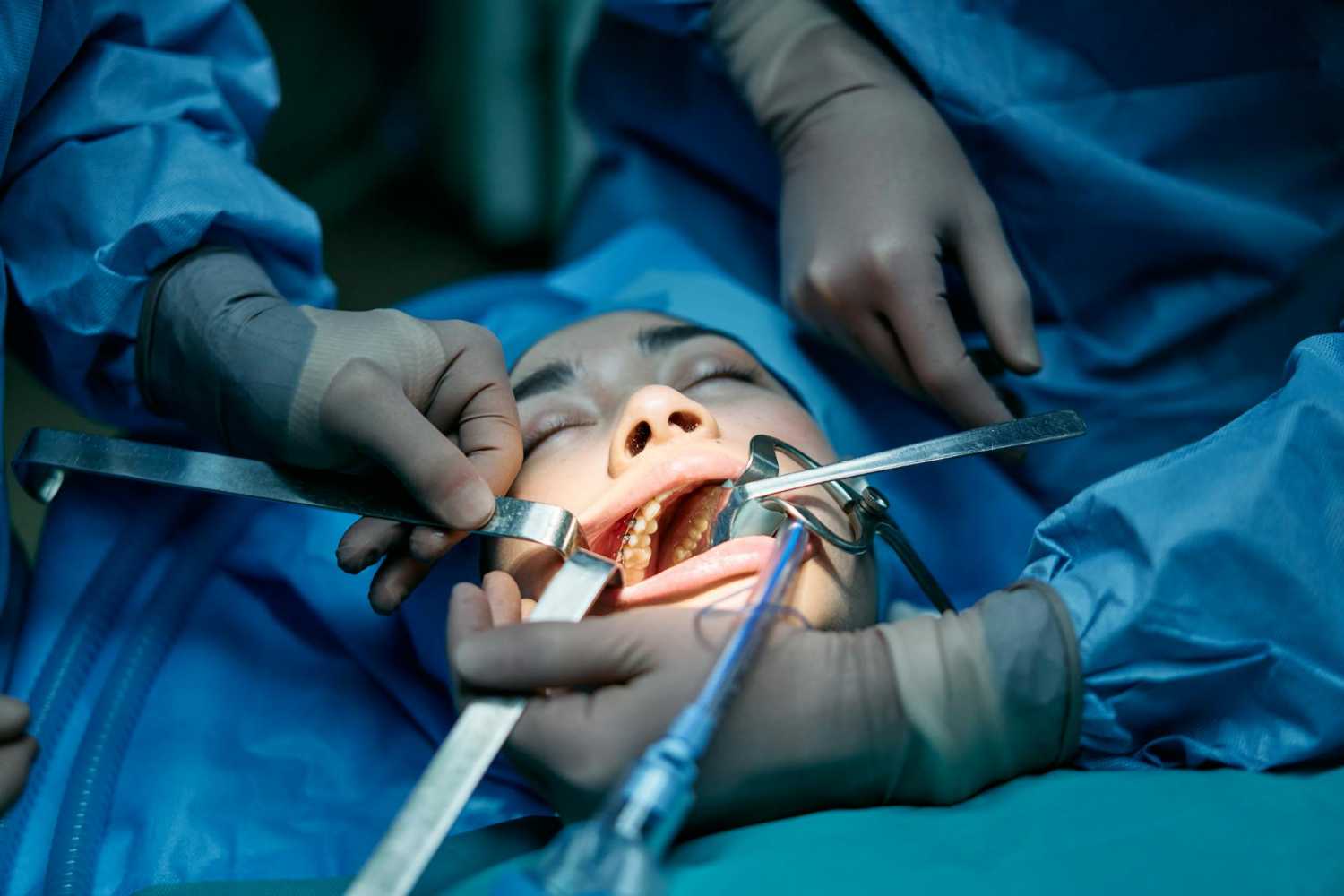 متخصص عمل لیزری فک در ایران