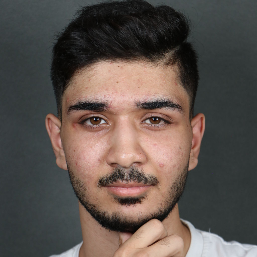 تصویر بعد از جراحی آسیب صورت و فک محمدرضا مافی