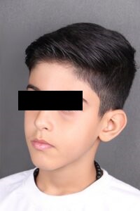مراجعه کننده جراحی فک تصادفی در کلینیک دکتر شهاب عزیزی