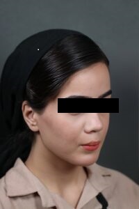 زیبا جو از کلینیک دکتر عزیزی