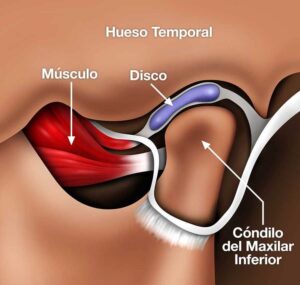انواع مشکلات مفصل گیجگاهی فکی کدامند؟