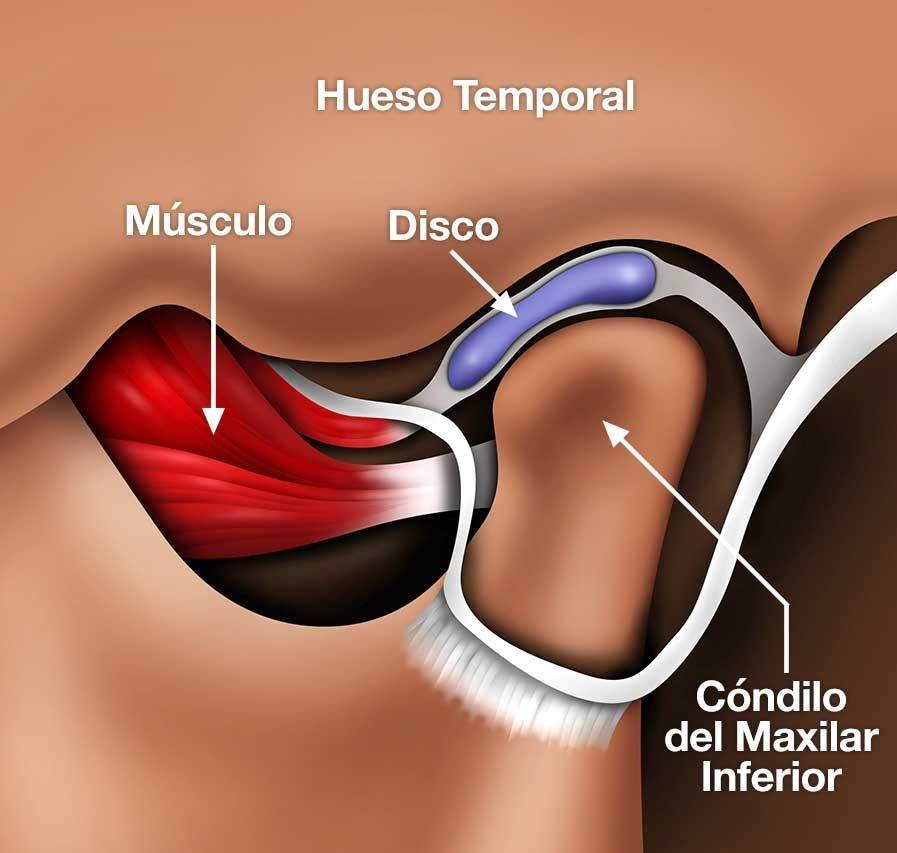 انواع مشکلات مفصل گیجگاهی فکی کدامند؟