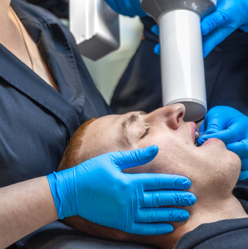 جراحی شکستگی ماگزیلا