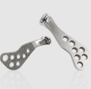 استفاده از پروتز پیش ساخته در شکستگی دو طرفه مفصل فک