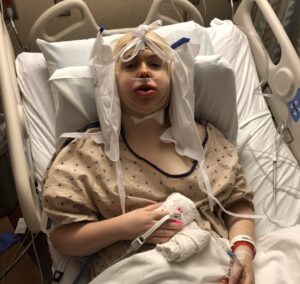 شیوه درست استراحت و خوابیدن بعد از عمل فک