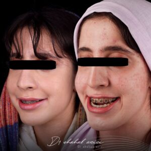 نمونه عمل ارتوگناتیک فک