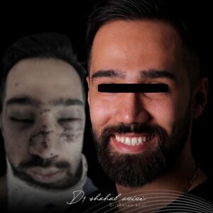 جراحی شکستگی فک و صورت